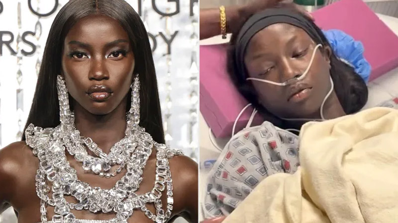 Supermodel Anok Yai, 28, shares diagnosis of congenital lung defect After months of breathing struggles